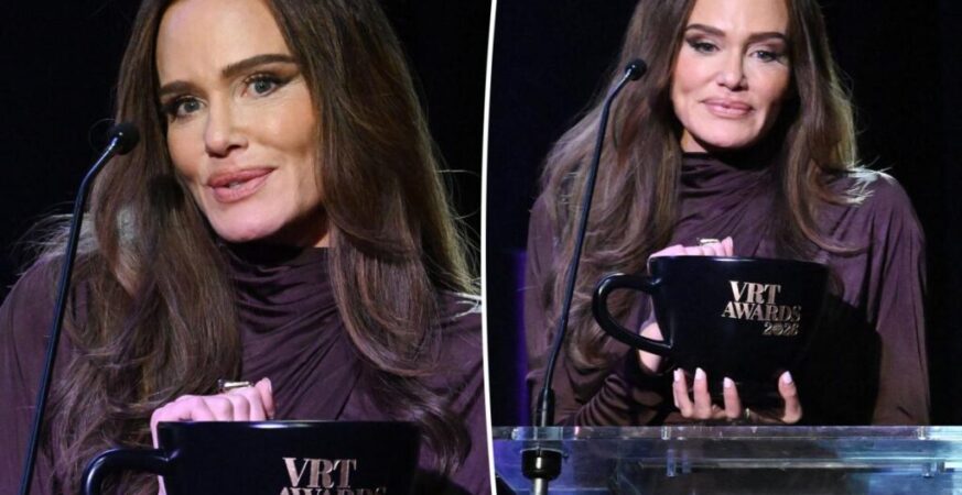 Meredith Marks o kulisach szybkiego powrotu do formy po liftingu twarzy